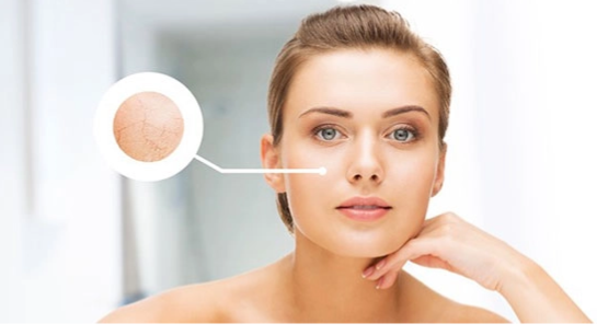 کرم آبرسان قوی برای پوست خیلی خشک