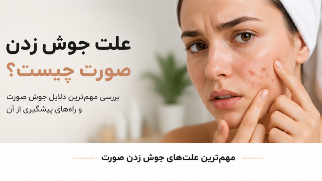 علت جوش زدن صورت چیست؟ 6 دلیل اصلی و راه‌های جلوگیری از آن