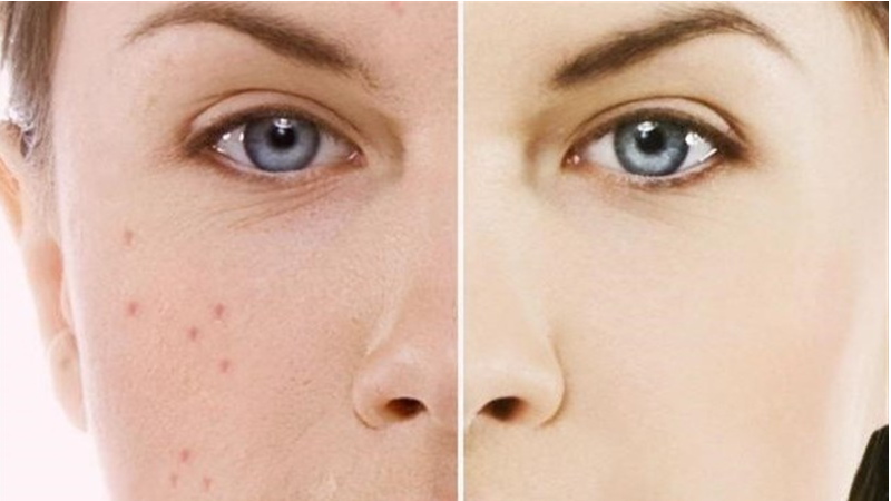 # 5 اشتباه رایج در مراقبت از پوست که باعث پیر شدن زودرس میشوند!