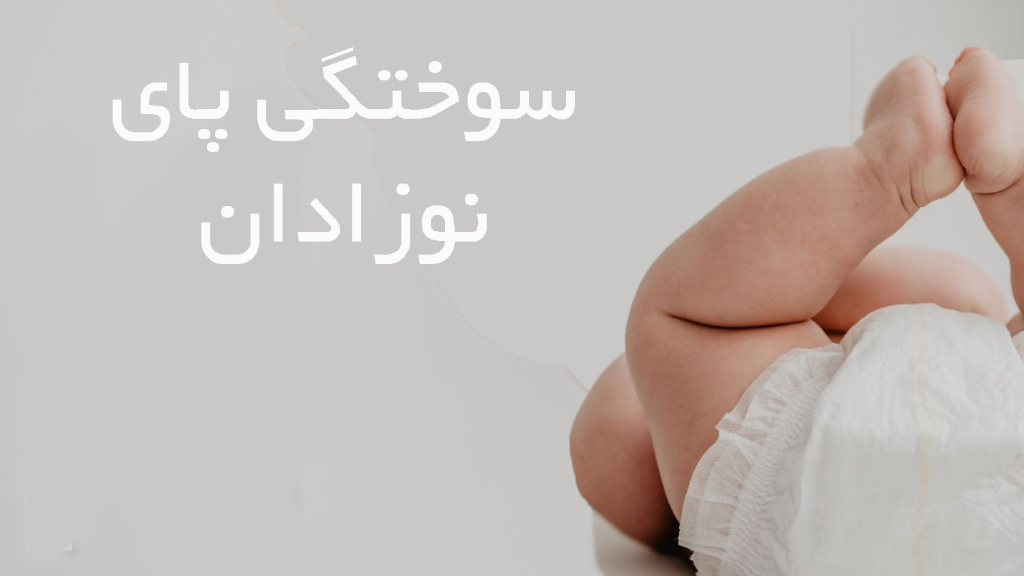 سوختگی پای نوزاد