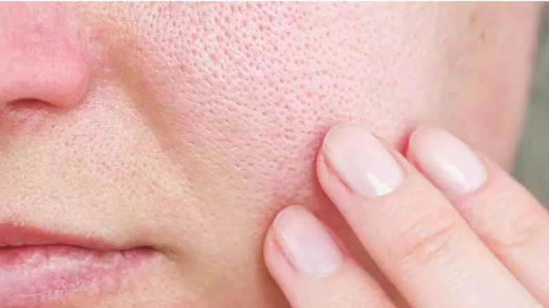 منافذ باز پوست