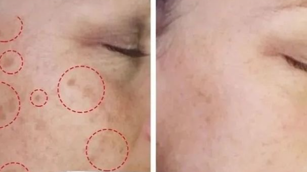 ترکیبات مضر در محصولات پوستی که باید از آن‌ها پرهیز کرد