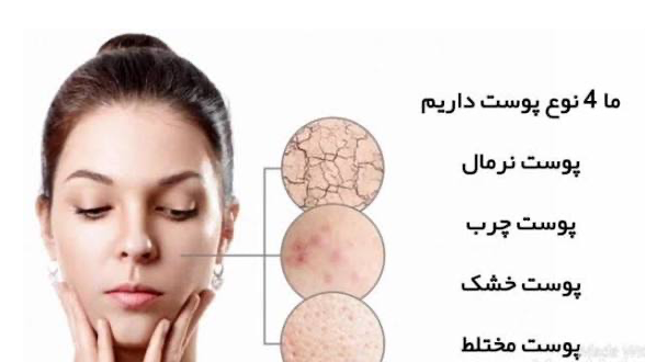 چگونه در خانه نوع پوست خود را بشناسیم