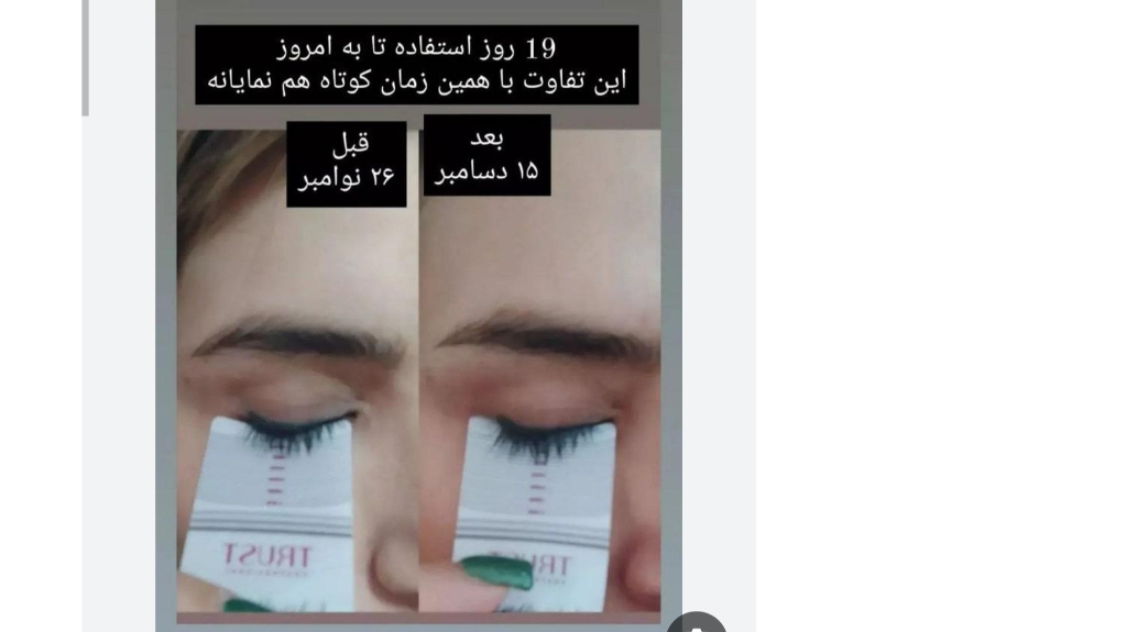 سرم تقویت مژه تراست