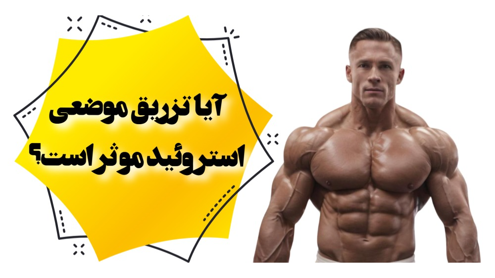 آیا تزریق موضعی استروئید موثر است؟