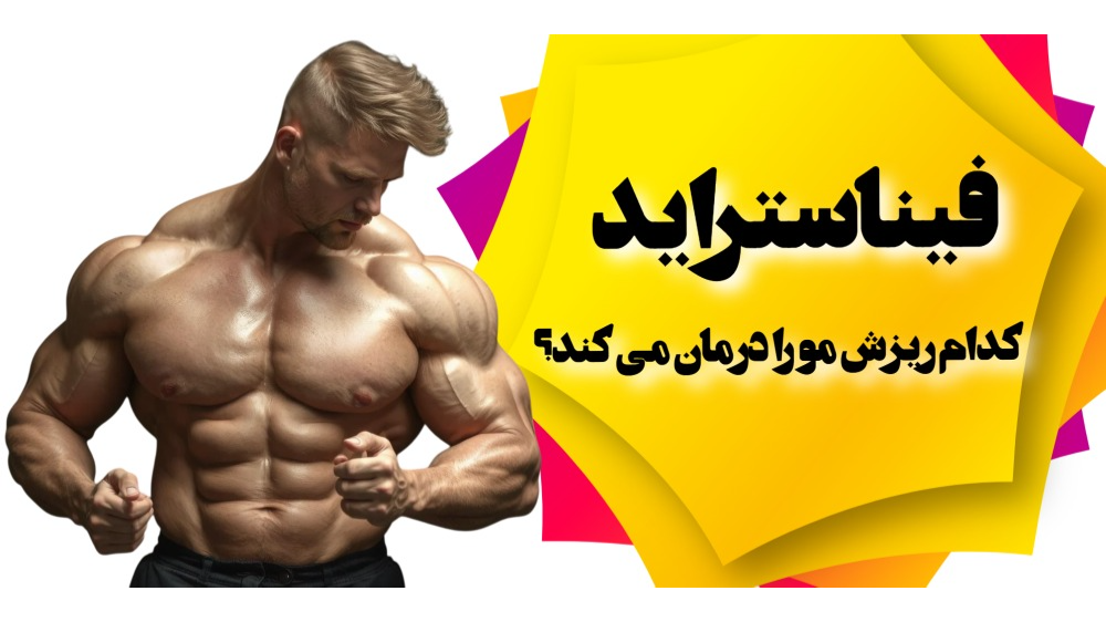 فیناستراید کدام انواع ریزش مو را درمان می کند؟