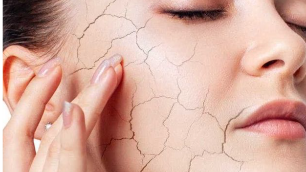 خشکی پوست و دلایل بروز آن