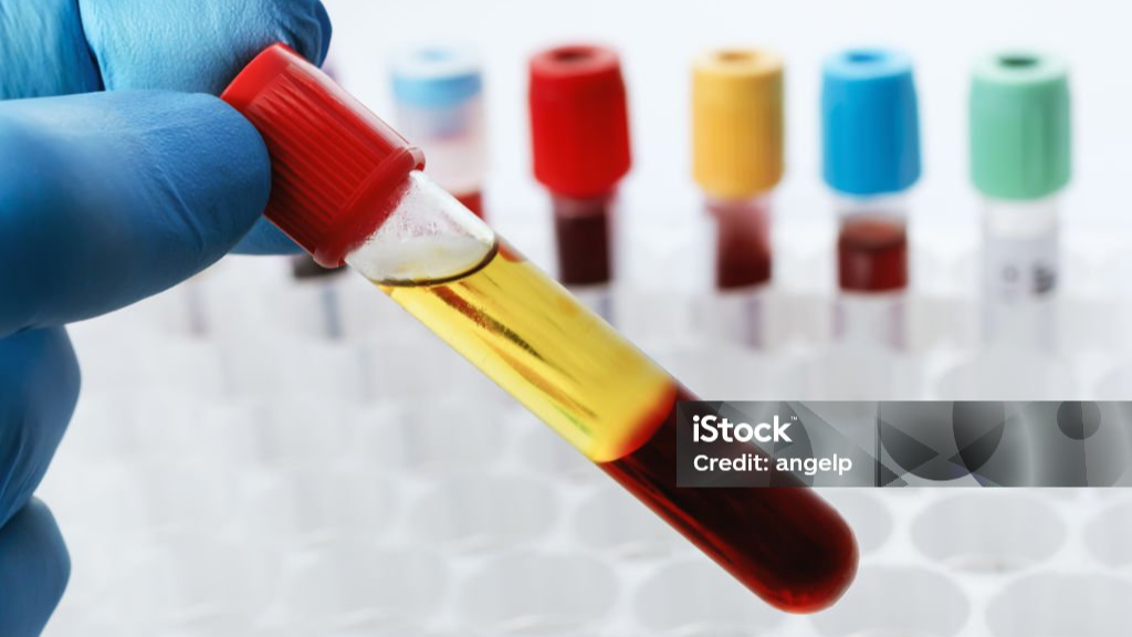 چه کیت PRP مناسب است؟ کاربرد ها ، مزایا و راهنمایی خرید