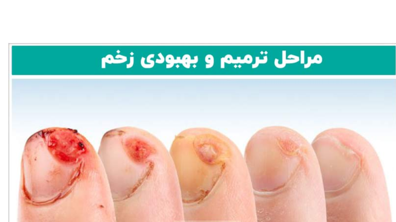 مراحل ترمیم و بهبودی زخم