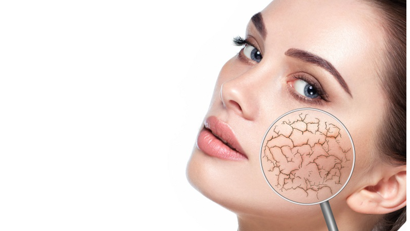 راههای جلوگیری از خشک شدن پوست